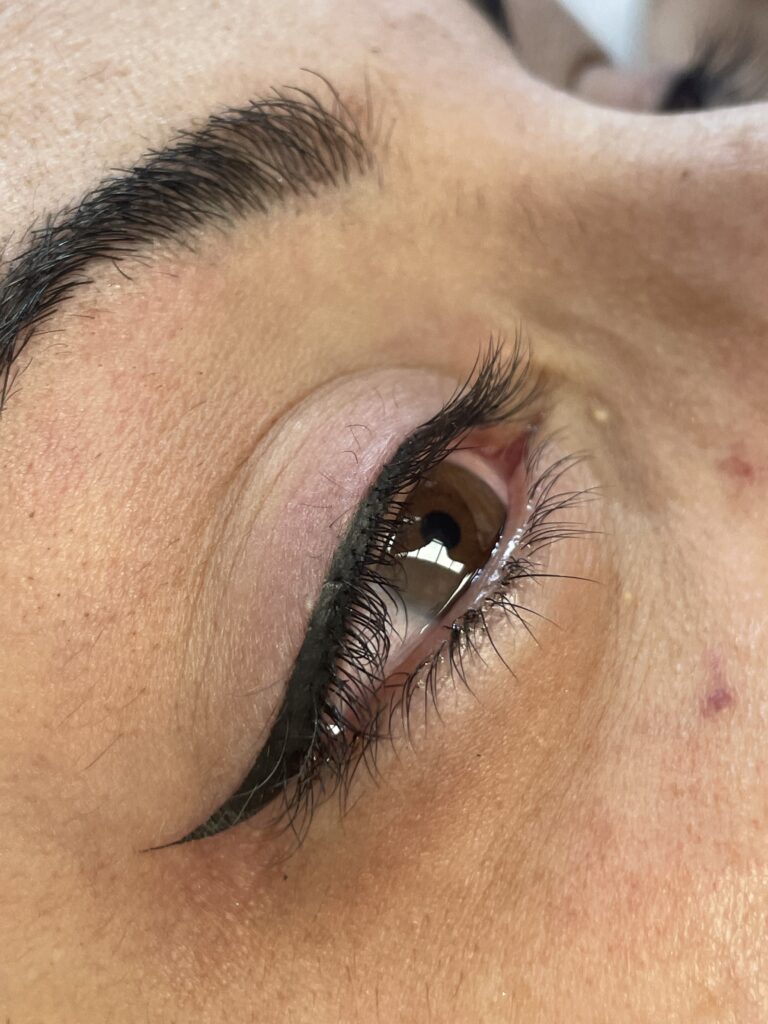 OJOS