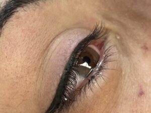 OJOS