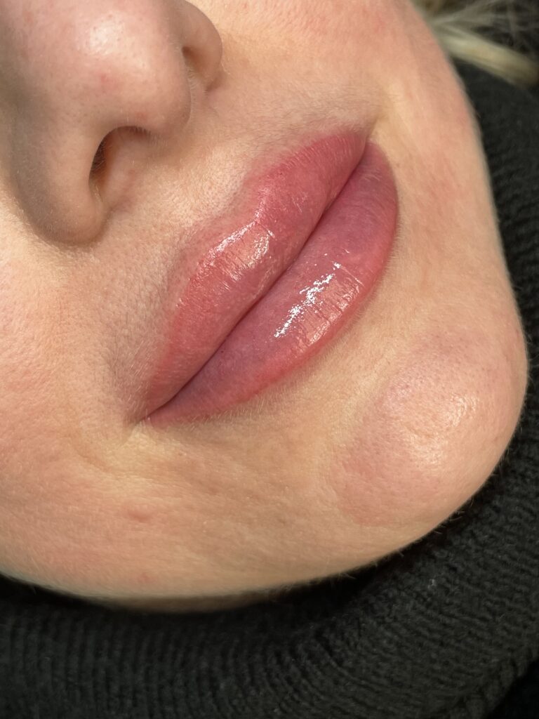 LABIOS