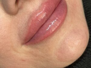 LABIOS