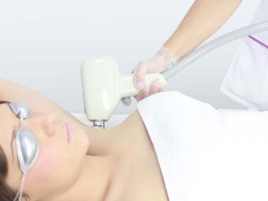 DEPILACIÓN LASER DOIDO AXILAS