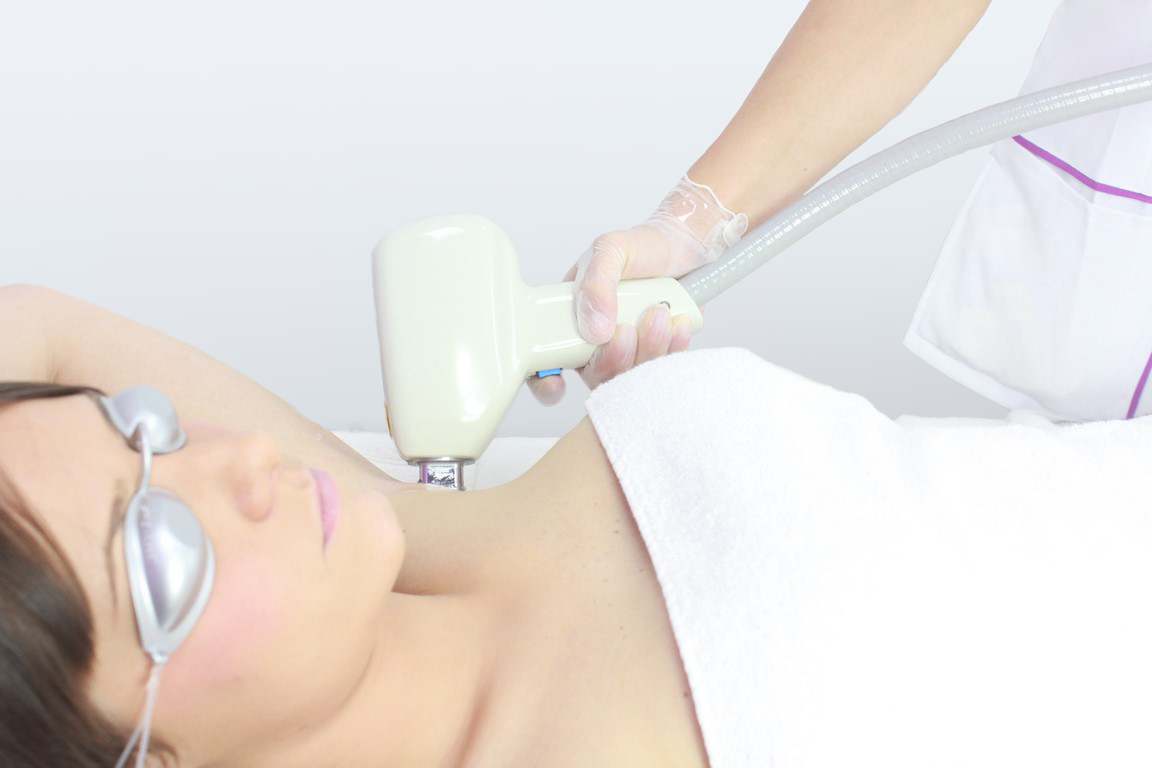 DEPILACIÓN LASER DOIDO AXILAS